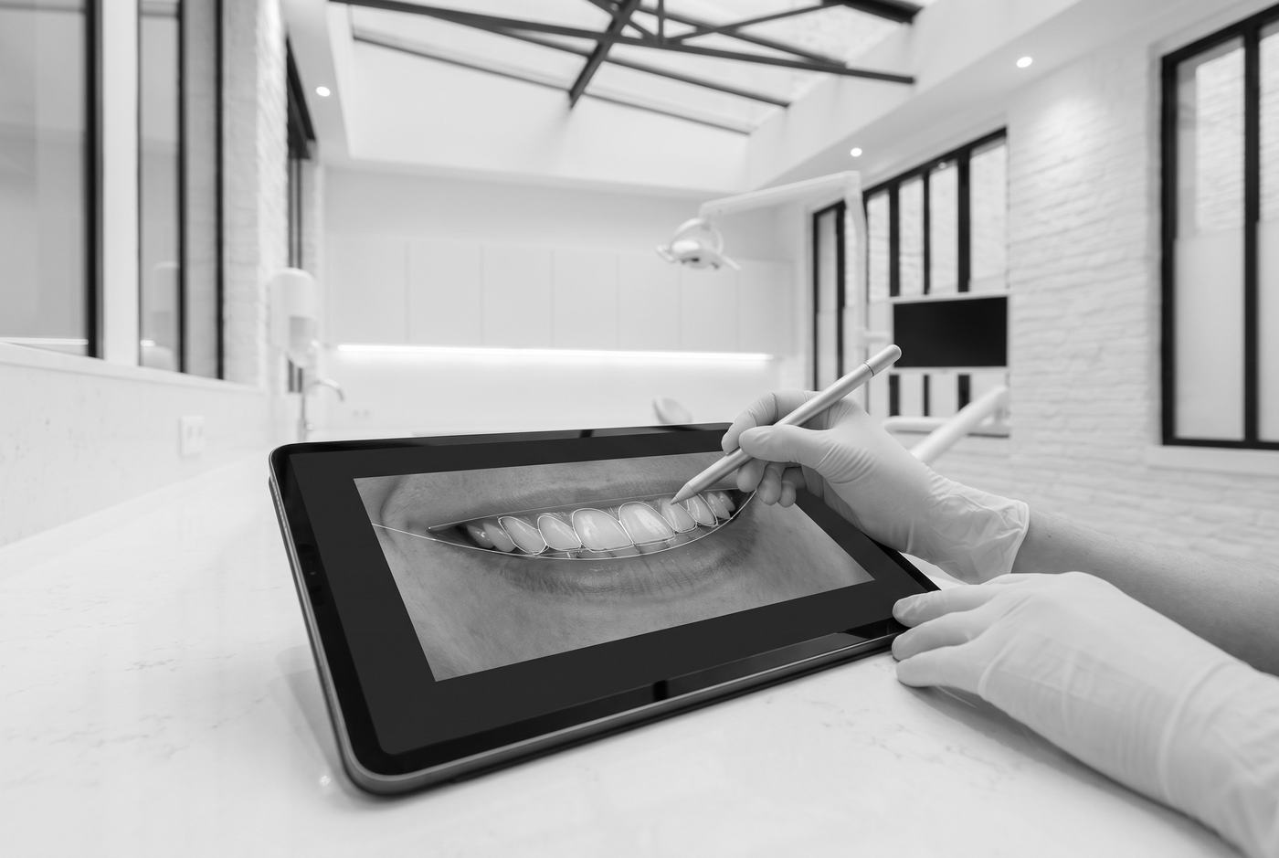 Des mains tracent au stylet la ligne du sourire sur une photo des dents, à l'écran d'une tablette