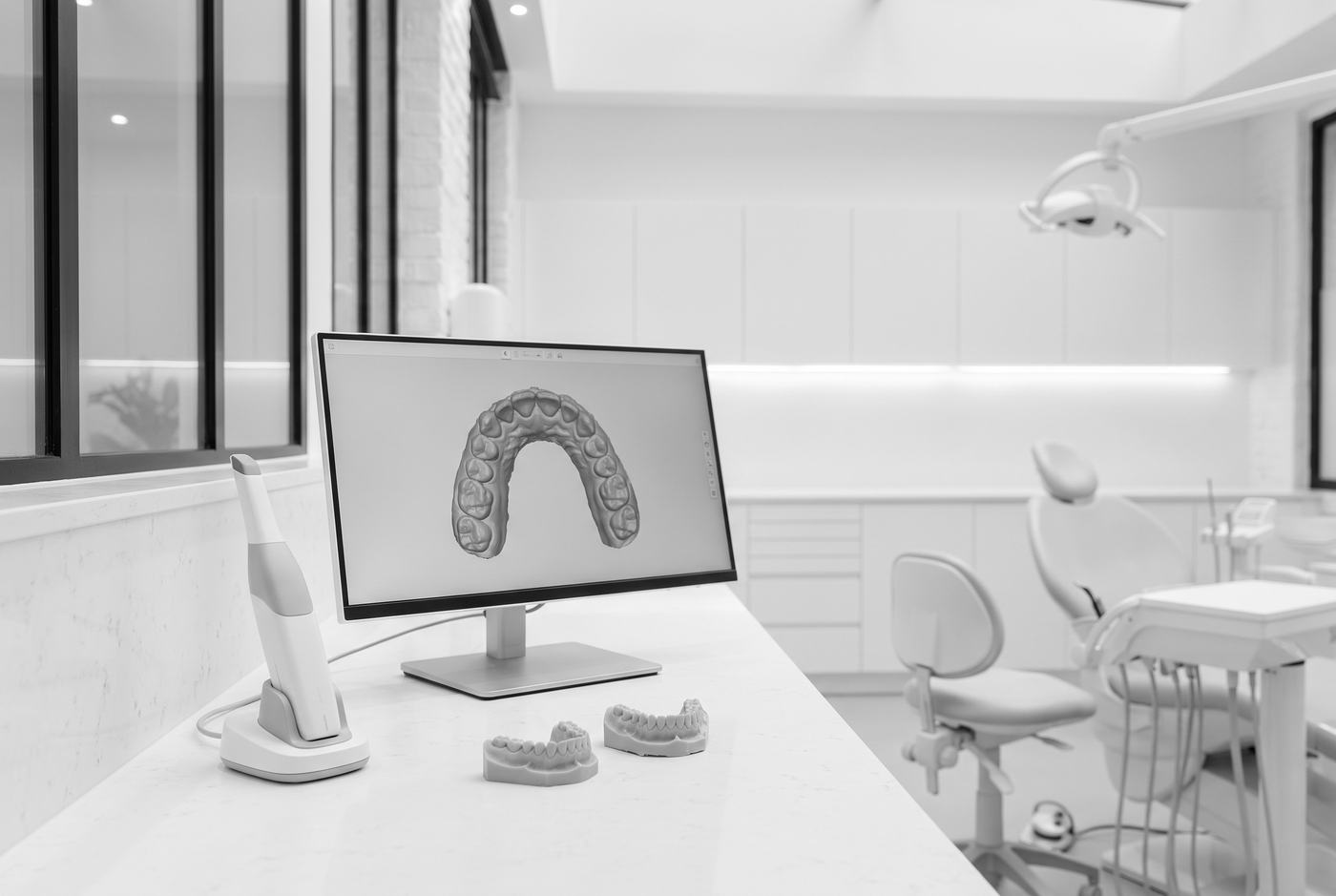 Inlay, onlay ou couronne : garder le plus de dent possible